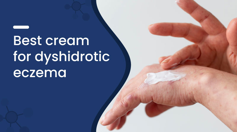 Best Cream for Dyshidrotic Eczema​