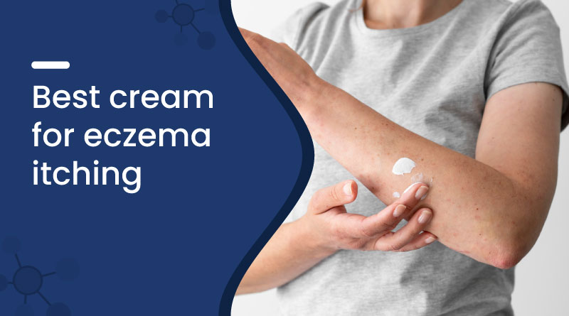 Best Cream for Eczema Itching​