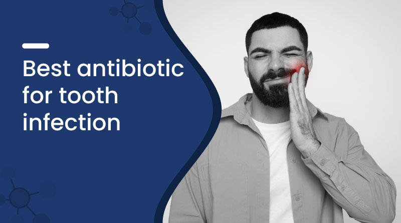 Best Antibiotic For Tooth Infection