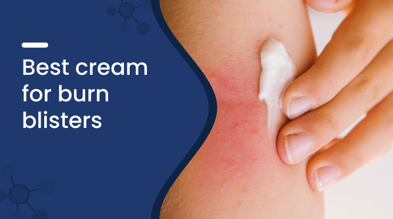 Best Cream For Burn Blisters