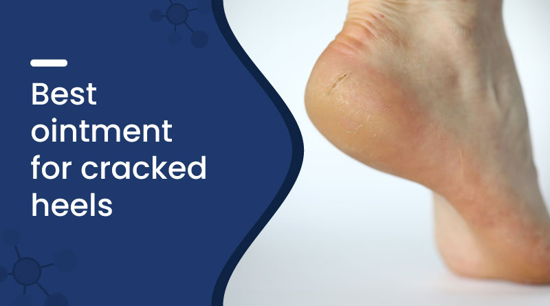 Best Ointment for Cracked Heels &ndash; Heal Dry, Painful Feet Fast