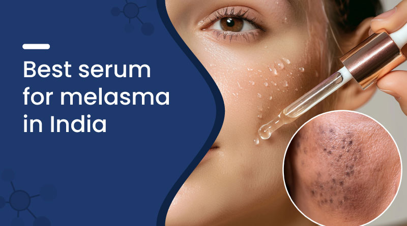 Best Serum for Melasma in India &ndash; Fade Dark Spots & Pigmentation
