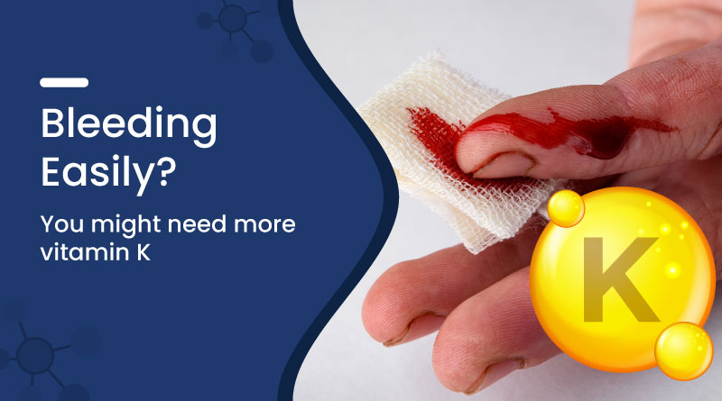 Bleeding Easily? You Might Need More Vitamin K