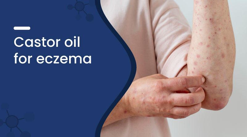Castor Oil for Eczema