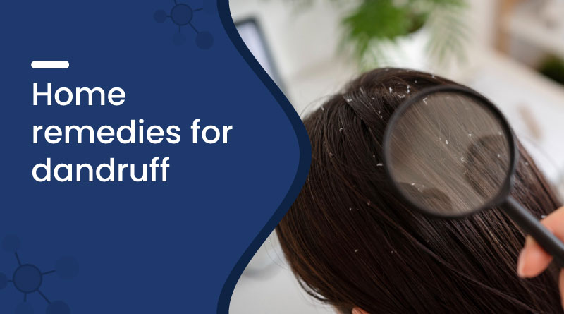 Home Remedies for Dandruff &ndash; Natural Ways to Get Flake-Free Hair