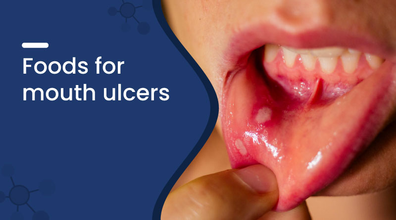 Best Foods for Mouth Ulcers: Heal Sores Naturally