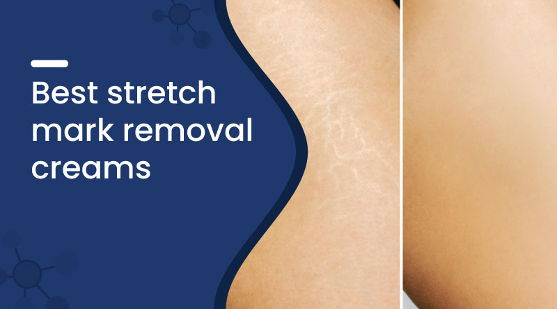 Best Stretch Mark Removal Creams in India