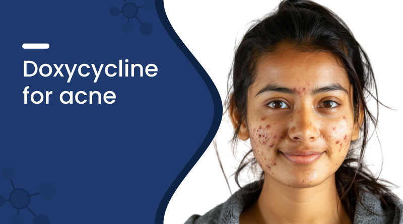Doxycycline for Acne