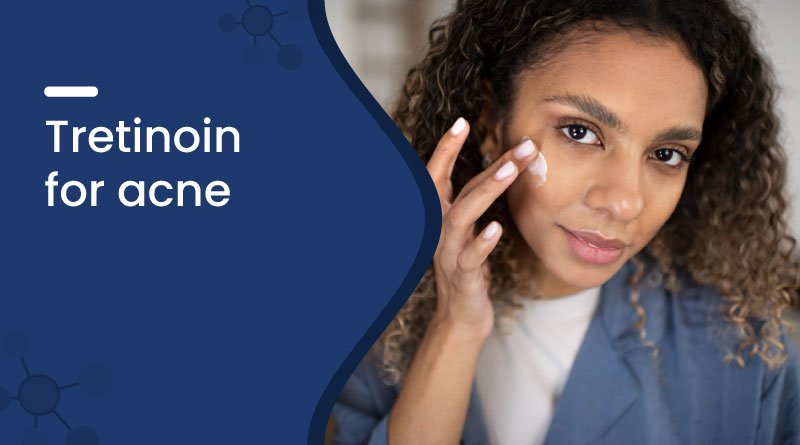 Tretinoin for Acne