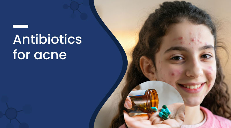 Best Antibiotics for Acne &ndash; Types, Benefits, Uses & Side Effects