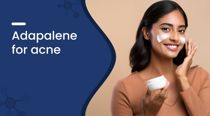 Adapalene for Acne