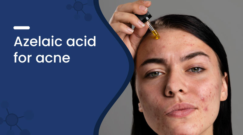 Azelaic Acid for Acne