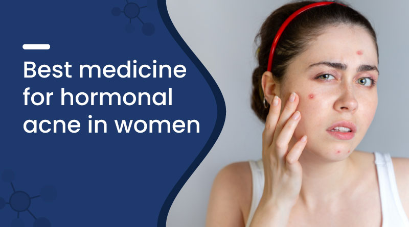 Best Medicine for Hormonal Acne in Women