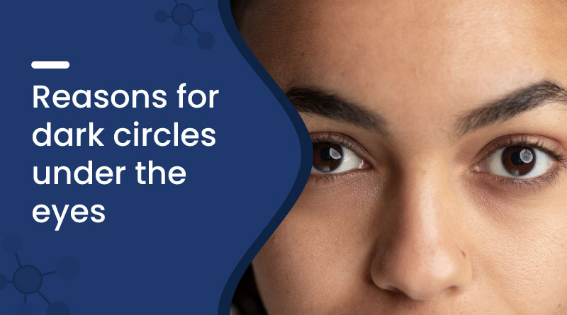 Reasons for Dark Circles Under The Eyes​
