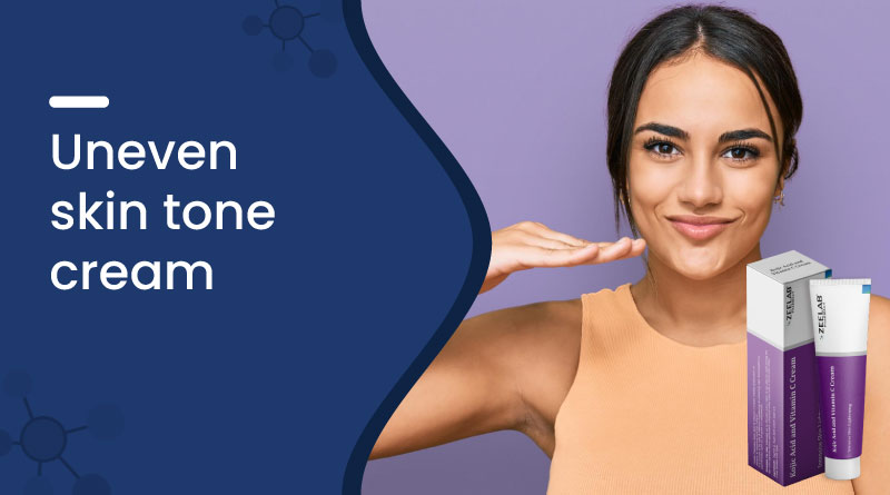 Best Uneven Skin Tone Cream