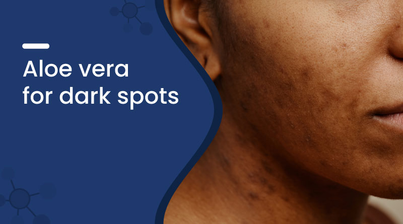 Aloe Vera for Dark Spots