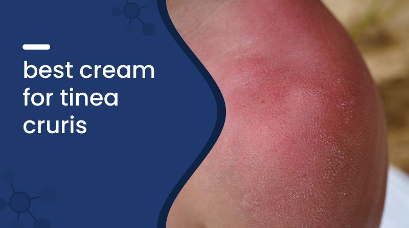 Best Cream For Tinea Cruris