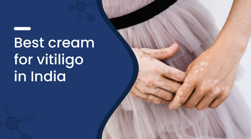 Best Cream For Vitiligo In India