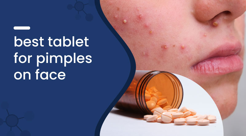 Best Tablet for Pimples on Face: Clear Acne Fast