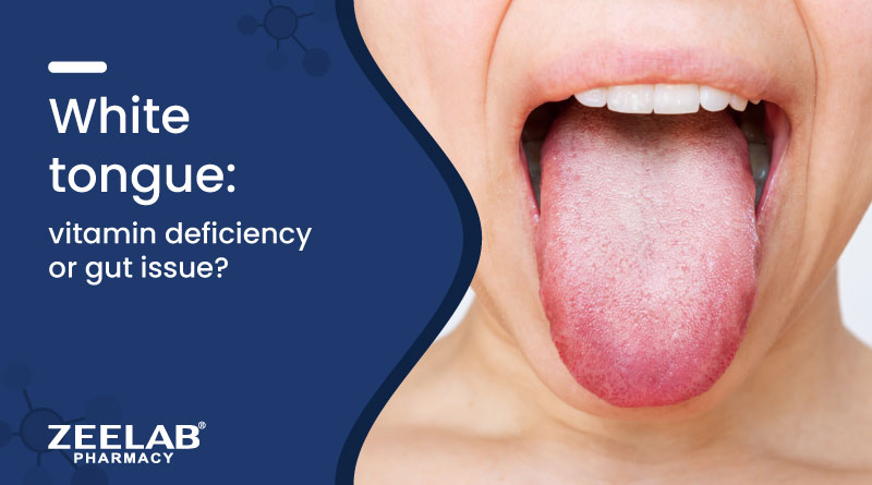 https://zeelabhealth.com/public/uploads/blogs/white-tongue-causes-vitamin-deficiency-gut-problems.jpg