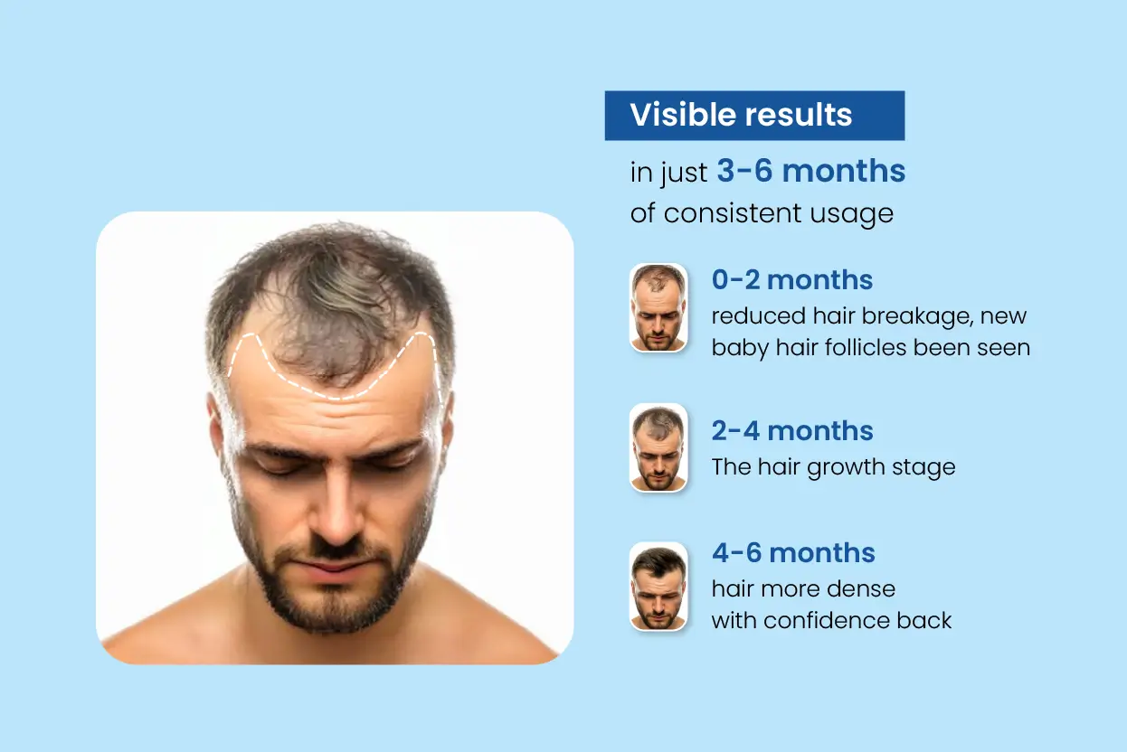 infoimages