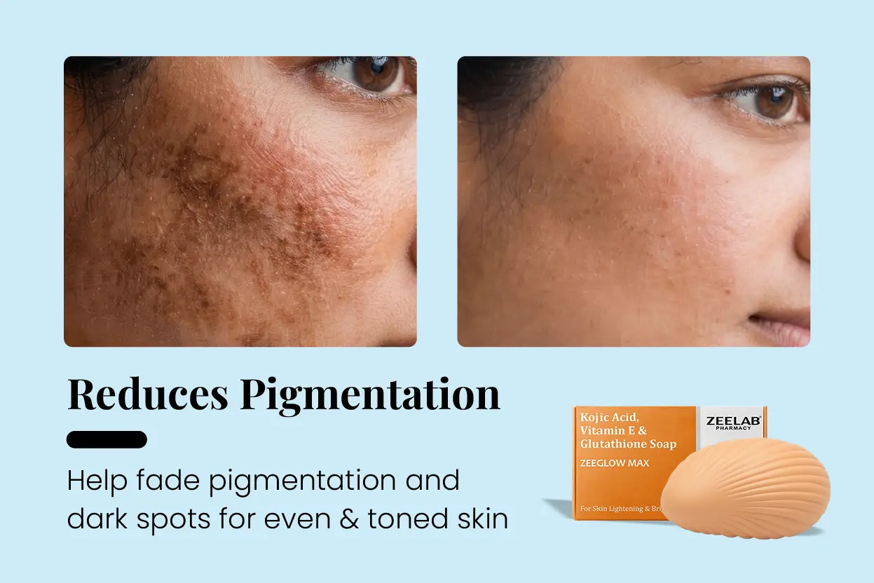 zeeglow max kojic acid soap for pigmentation and dark spots