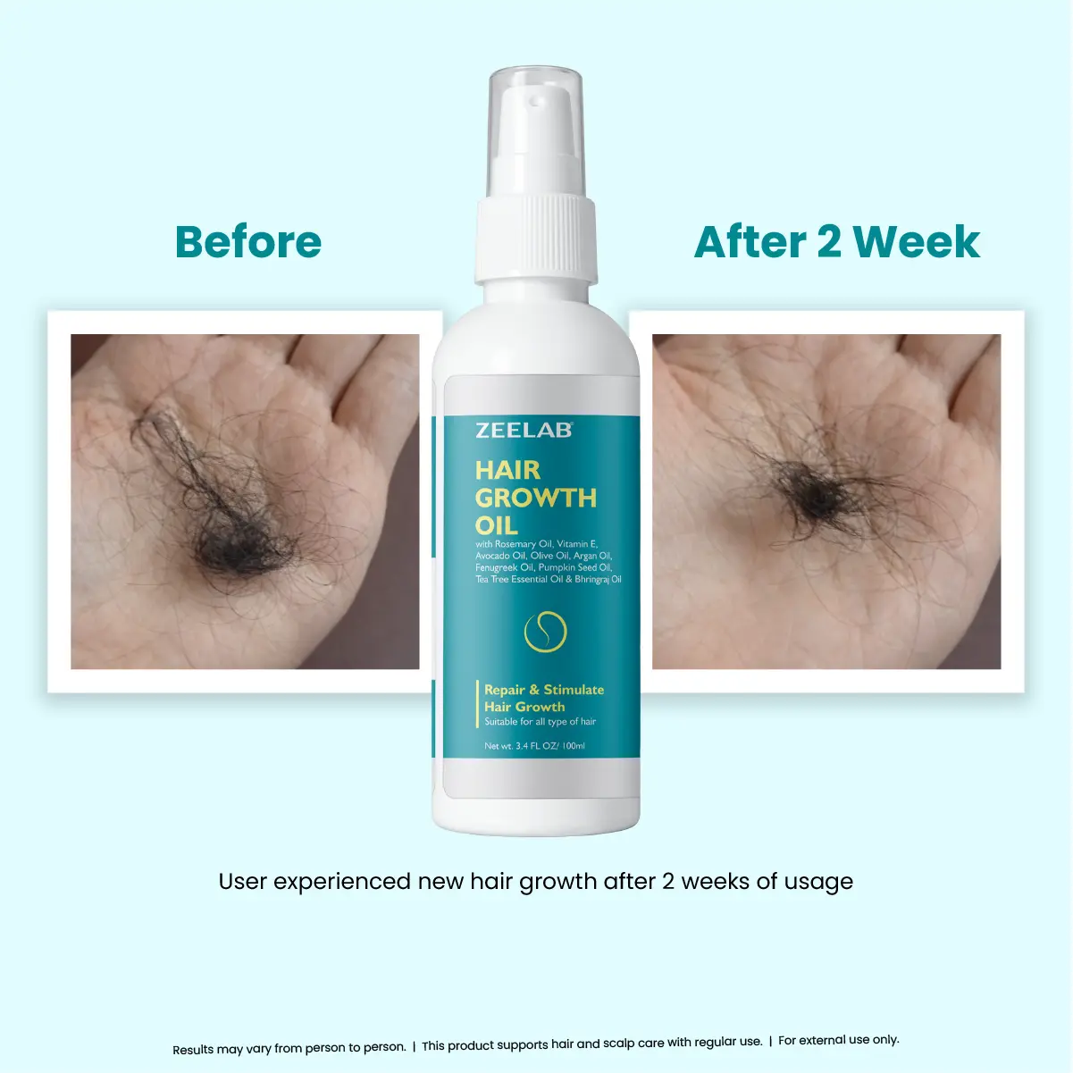 zeelab hair growth oil for regular hair and scalp care