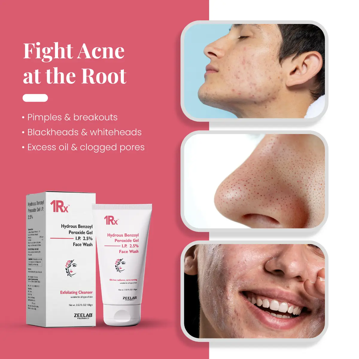 1RX Hydrous Benzoyl Peroxide 2.5% Face Wash